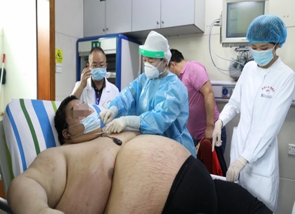 Pria Cina Ini Berat Badannya Naik 100 Kg