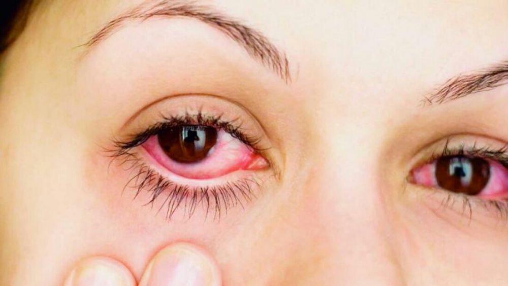 Kenali 5 Gejala Penyakit Glaukoma