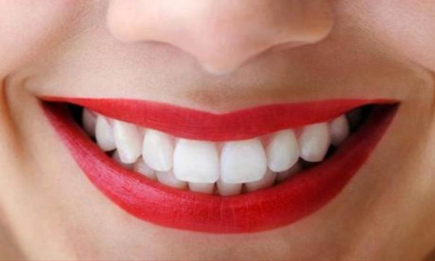 Tips Mudah Membuat Gigi Menjadi Putih