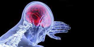 Ensefalitis adalah Peradangan pada Otak karena Virus, Kenali Gejala dan  Penyebabnya | merdeka.com